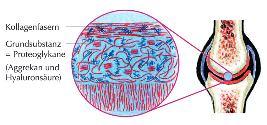 Grafische Zeichnung zur Struktur des Gelenkknorpels